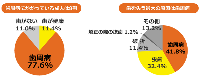 清瀬　さくらんぼ歯科の歯周病治療