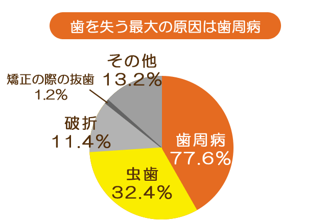 清瀬　さくらんぼ歯科の歯周病治療