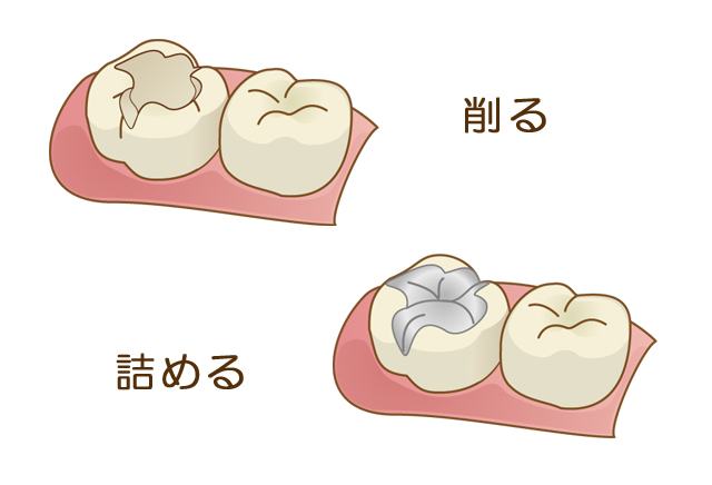清瀬さくらんぼ歯科の予防歯科