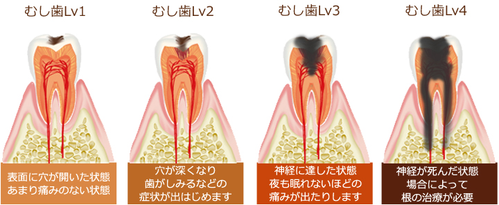 清瀬さくらんぼ歯科の予防歯科