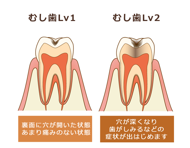 清瀬さくらんぼ歯科の予防歯科