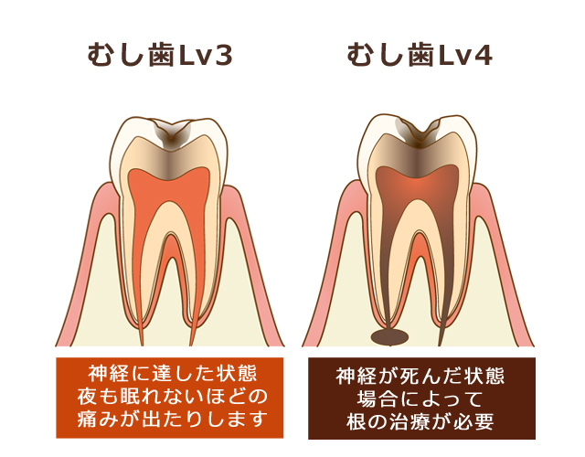 清瀬さくらんぼ歯科の予防歯科